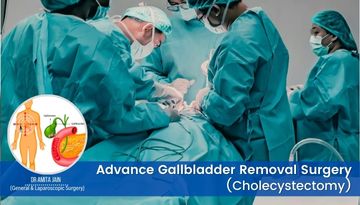 Dr Amita Jain the best Cholecystectomy surgeon